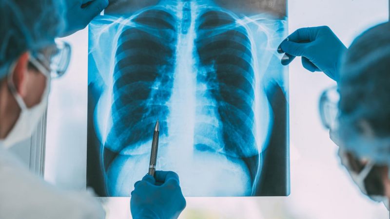 Тревожная статистика: в Жетісу продолжает расти заболеваемость туберкулезом
