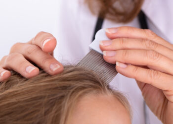 Вши любят чистые волосы? Вся правда о педикулезе и скрытой статистике