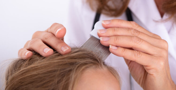 Вши любят чистые волосы? Вся правда о педикулезе и скрытой статистике